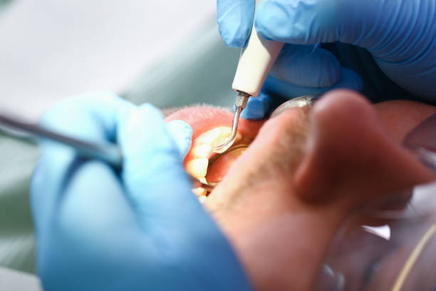 Best Emergency Gum Treatment in Yuma, AZ